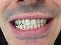 Centereach Cosmetic Dentist