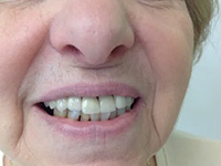 Emergency Dentist Centereach