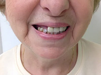 Centereach Cosmetic Dentist