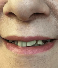 Dentist in Centereach