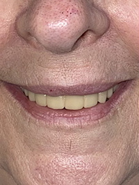 Virginia M. Mitchell, DDS, PC | Periodontal Treatment, Teeth Whitening and Dental Cleanings