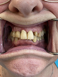 Virginia M. Mitchell, DDS, PC | Oral Cancer Screening, Cosmetic Dentistry and Implant Restorations