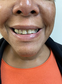 Virginia M. Mitchell, DDS, PC | Implant Dentistry, Periodontal Treatment and Emergency Treatment